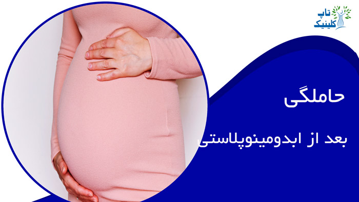 حاملگی بعد از ابدومینوپلاستی