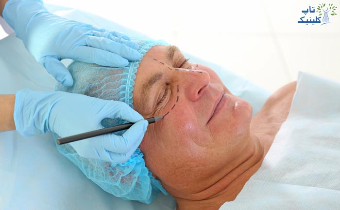 میانگین سنی برای جراحی زیبایی بینی