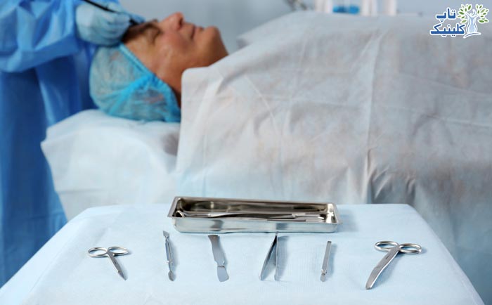 پیشگیری از عوارض جراحی بینی برای افراد 40 سال