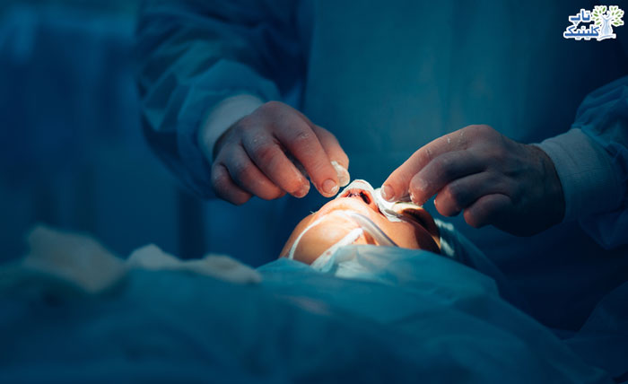 فرایند عمل جراحی بینی در افراد با بیماری قلبی (رینو پلاستی)