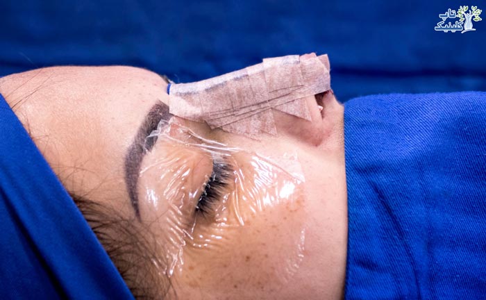 چگونه می توان کم خونی قبل از جراحی بینی را درمان کرد؟