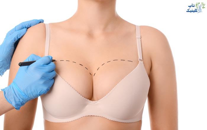 جراحی زیبایی سینه چیست و هدف از آن چه می باشد؟