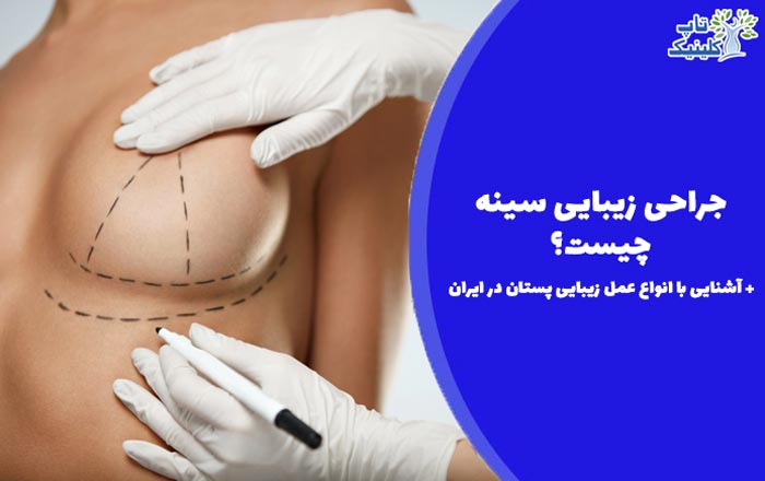 جراحی زیبایی سینه چیست؟ + آشنایی با انواع عمل زیبایی پستان در ایران