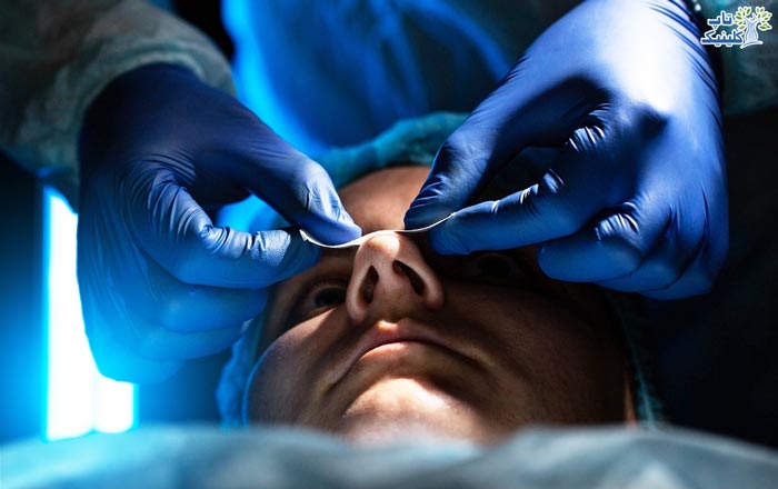 بهترین جراح بینی در تهران از چه تکنیک هایی برای عمل بینی استفاده می کند؟
