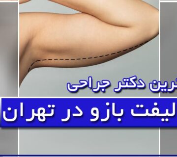 بهترین دکتر و جراح لیفت بازو (براکیوپلاستی) در تهران